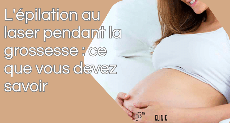 L'épilation au laser pendant la grossesse : ce que vous devez savoir