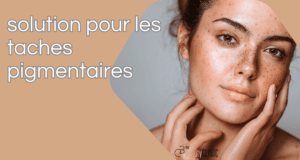 suppression des taches pigmentaires de la peau