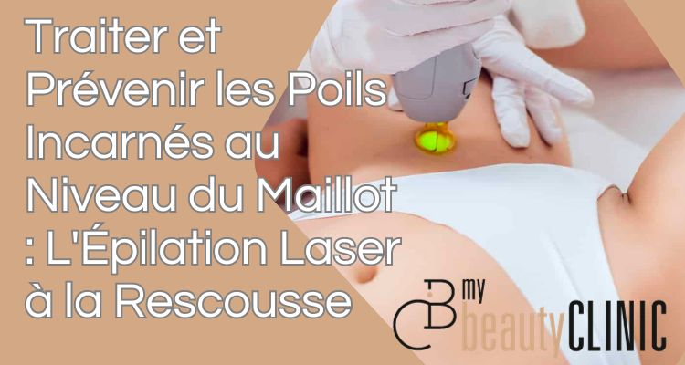 prévenir et traiter les poils incarnés par l'épilation laser au Luxembourg