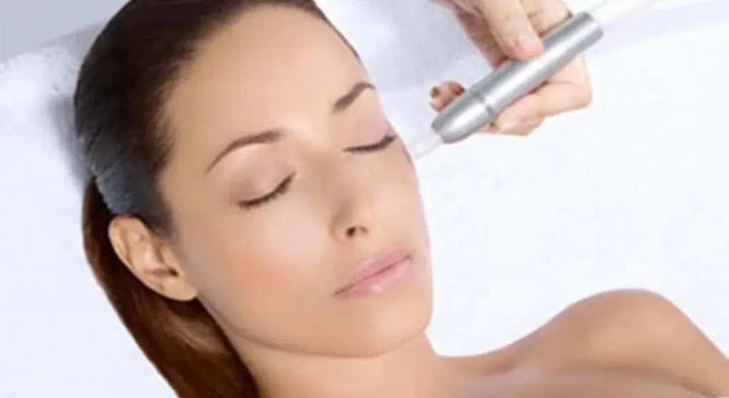 microdermabrasion